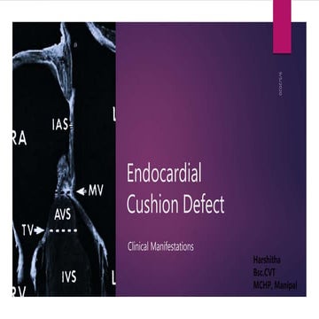 Endocardial Cushion Defect / AVSD