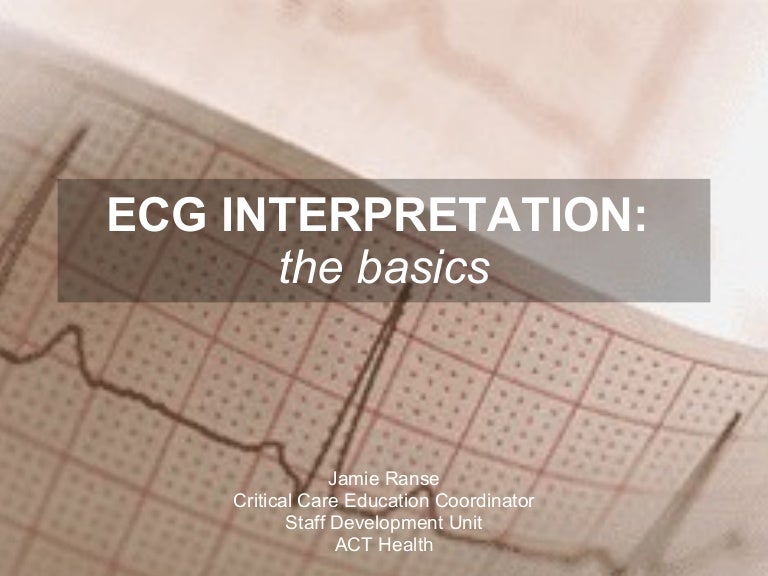 Ecg Interpretation The Basics