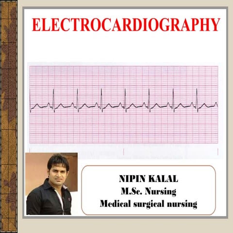 Ecg for Nurses...