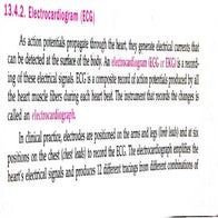 Ecg.