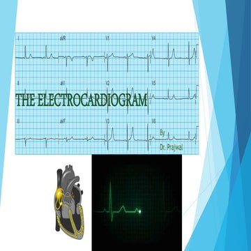 ECG - Electrocardiogram 
