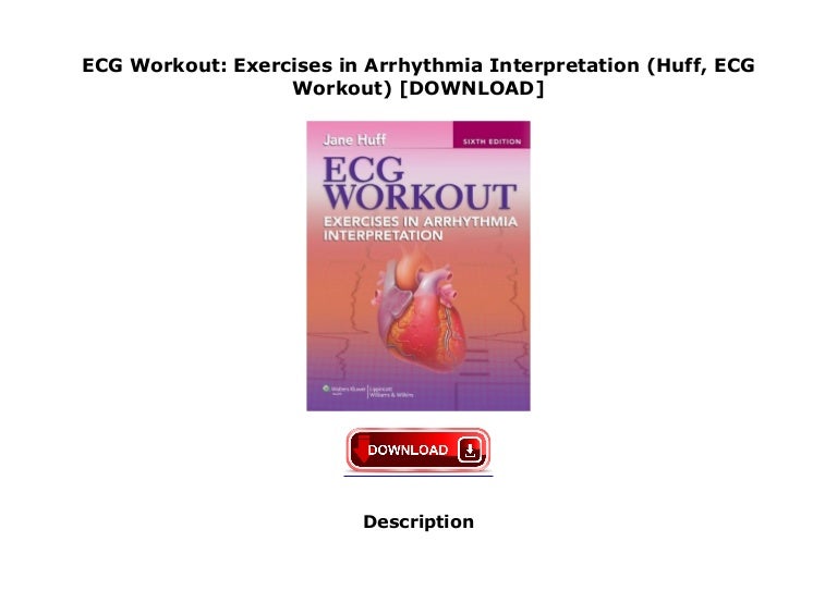 ECG Workout Exercises in Arrhythmia Interpretation (Huff, ECG