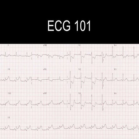 ECG 101