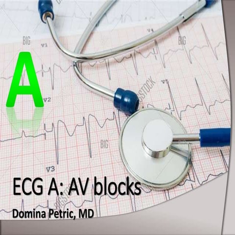 ECG A: AV blocks