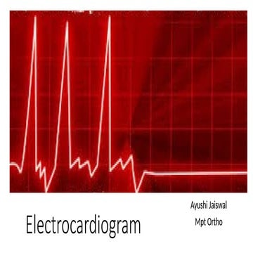 Introduction of ECG, or electrocardiogram