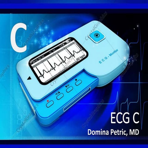 ECG C