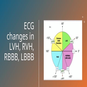 Electrocardiogram (ECG) Changes in LVH, RVH, RBBB, and LBBB Explained ...