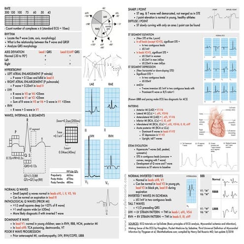 ECGcheatsheet52.pdf
