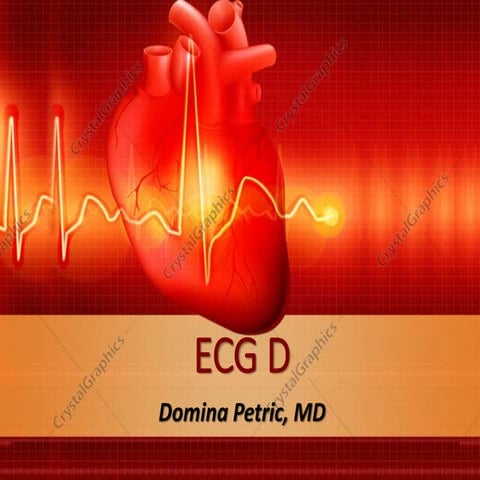 ECG D