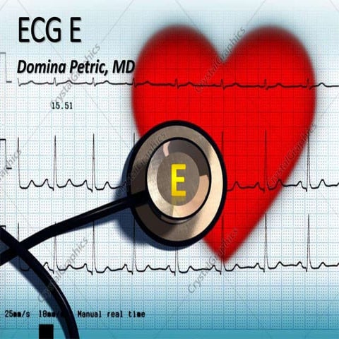 ECG E