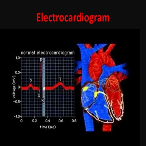 ECG [electrocardiogram].pptx