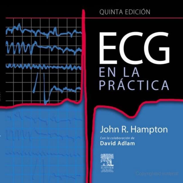 Ecg en la practica