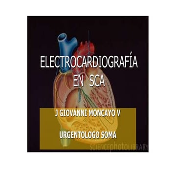 ECG EN SINDROME CORONARIO AGUDO