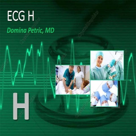 ECG H