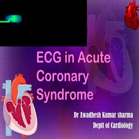 Ecg in acs