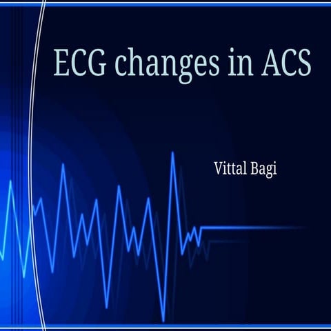electrocardiography in acute coronary syndrome.pptx
