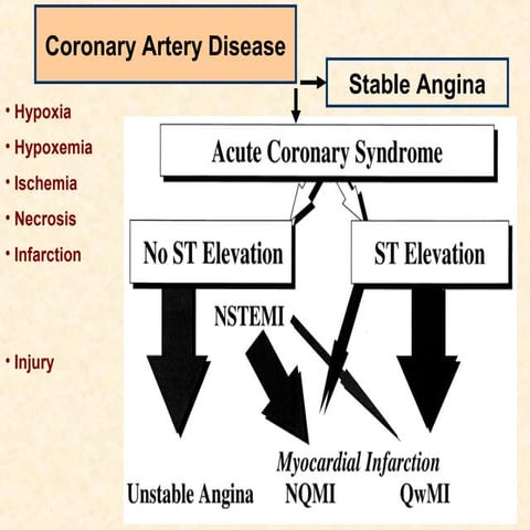 ECG in Coronary Artery Disease