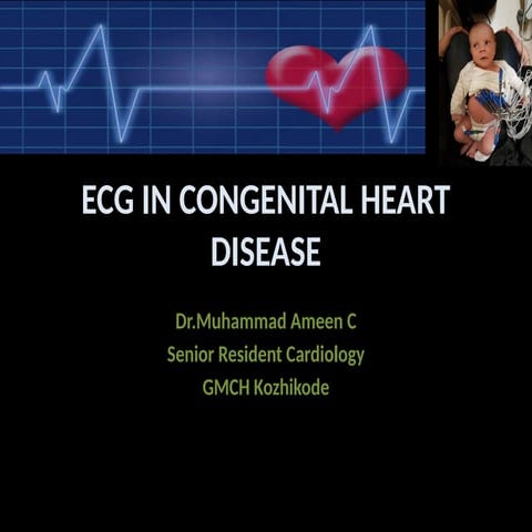 ECG IN CONGENITAL HEART DISEASE cardiology | PPTX