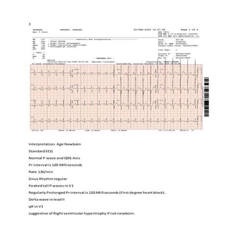 The pediatric electrocardiogram 1 | PDF
