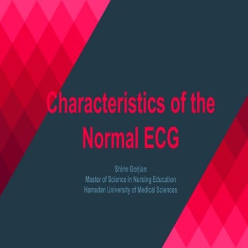 Characteristic of normal ECG