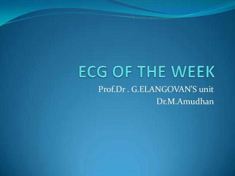 ECG Trifascicular Block