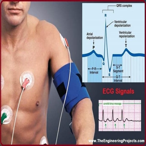 ECG   PRESENTED BY-  OM VERMA...