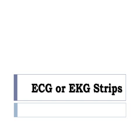 Ecg or ekg sample strips (MS Cardiovascular)