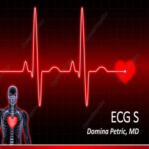 ECG S