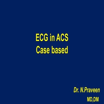 ECGs in Acute Coronary Syndrome