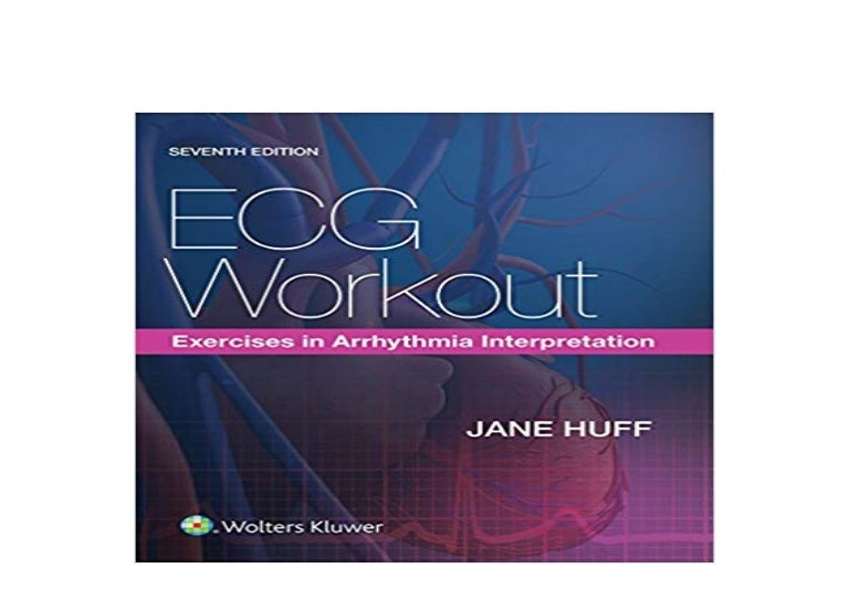 ((Read_[P.D.F])) ECG Workout Exercises in Arrhythmia Interpretation…