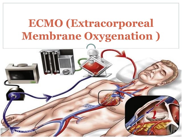 PPT - central line(Central Venous Catheters) | PPTX