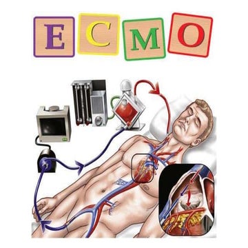 ECMO by DJ