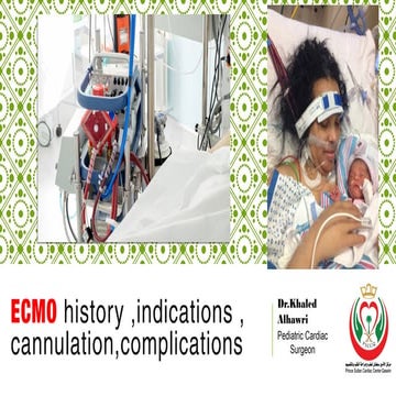 Ecmo history, indications, cannulation, complications