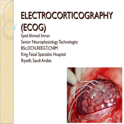 Electrocorticography