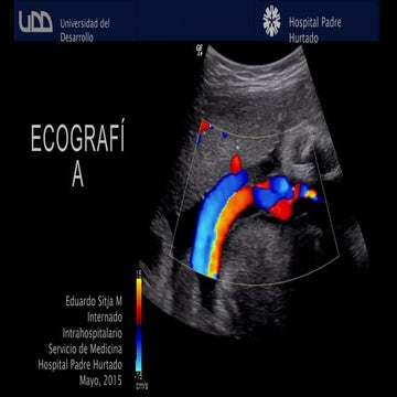 Ecografías: ecodoppler y ecocardiografìa