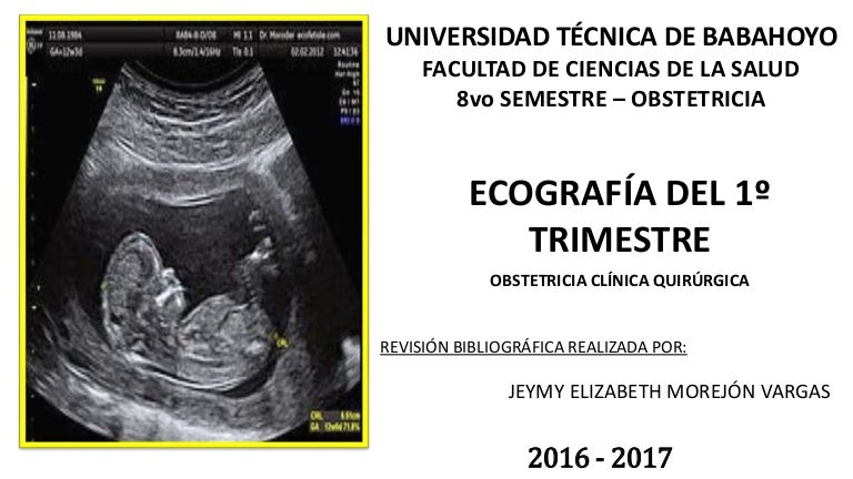 sintomas aborto 13 semanas embarazo
