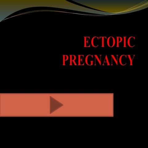 Ectopic pregnancy