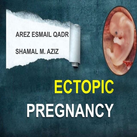 Ectopic pregnancy
