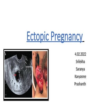 ectopic%204th%20February%20obgectopic.pptx