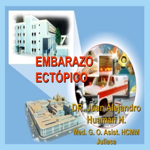 Ectopico Embarazo Jahh