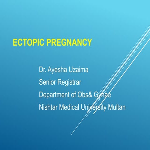 Title.   ECTOPIC PREEGNANCY NEW (2).pptx