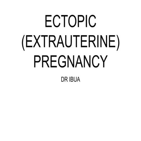 ECTOPIC PREGNANCY-1.ppt