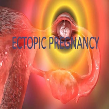 ECTOPIC PREGNANCY-obsetrics & Gynae.pptx