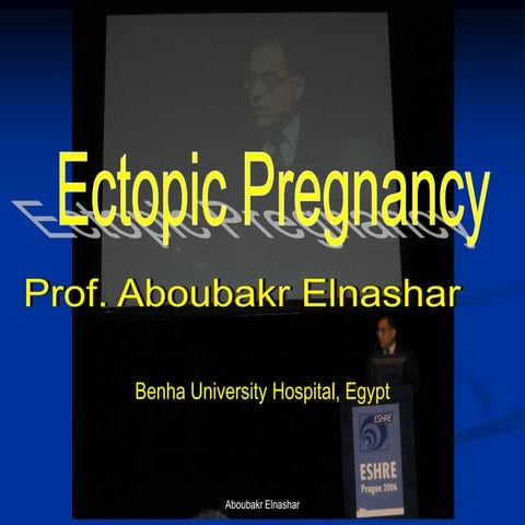 Ectopic pregnancy