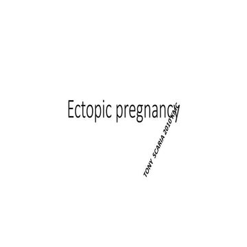 Ectopic pregnancy revision notes