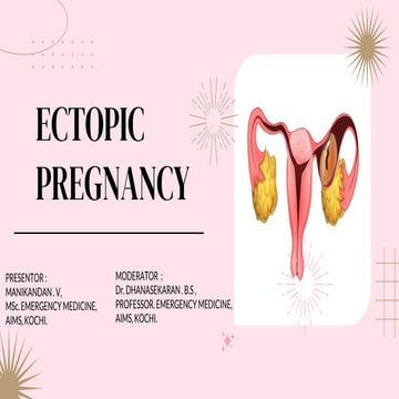 Ectopic pregnancy.pptx