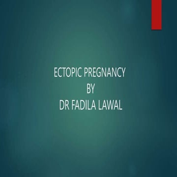 ectopic pregnancy 2 copy.pptx