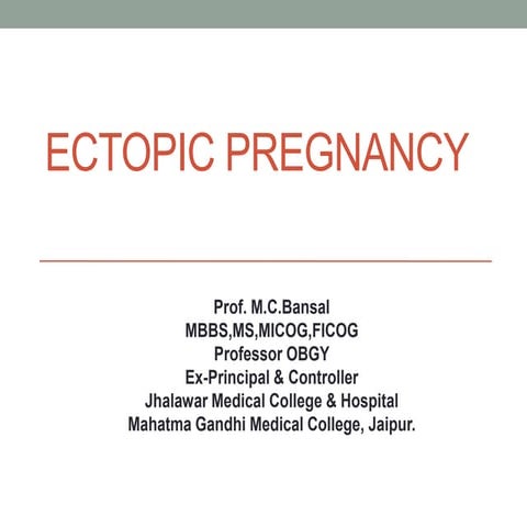 Ectopic pregnancy rs