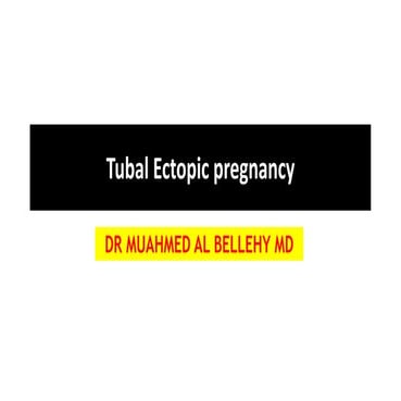 ectopic pregnancy Ultrasound Daignosis.pdf