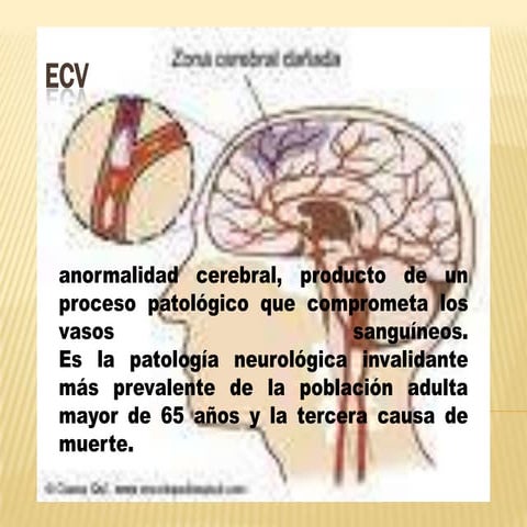 MAPAS ECV | PPTX